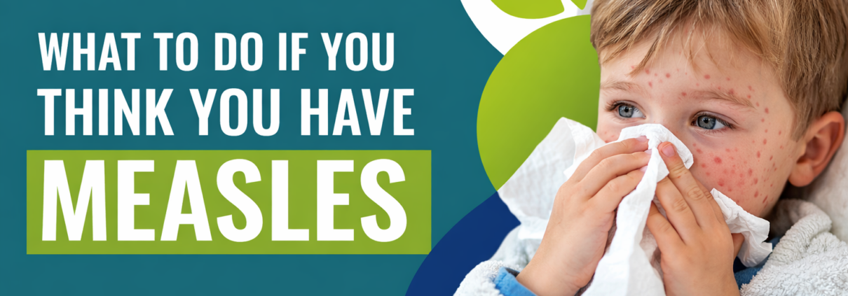 What to do if you have measles.