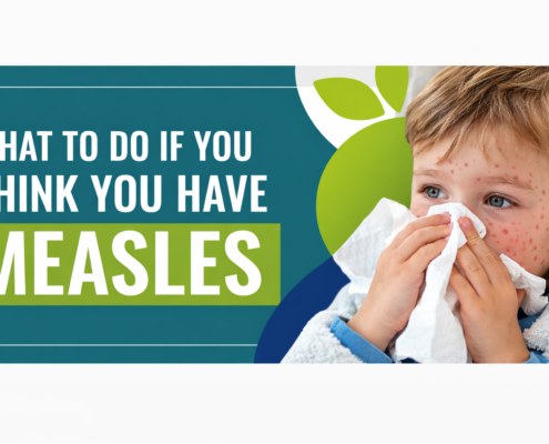 What to do if you have measles.