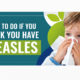 What to do if you have measles.