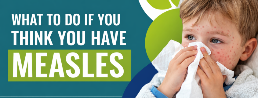 What to do if you have measles.